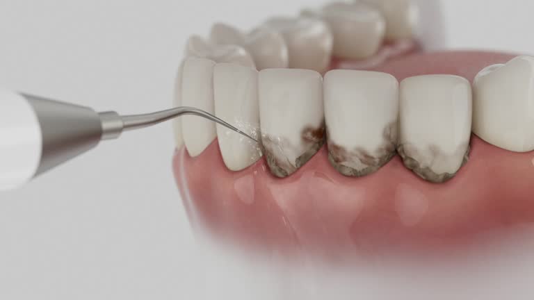 Trusted Dental Crowns And Bridges service in Stuttgart, AR - Dentist Open Now
